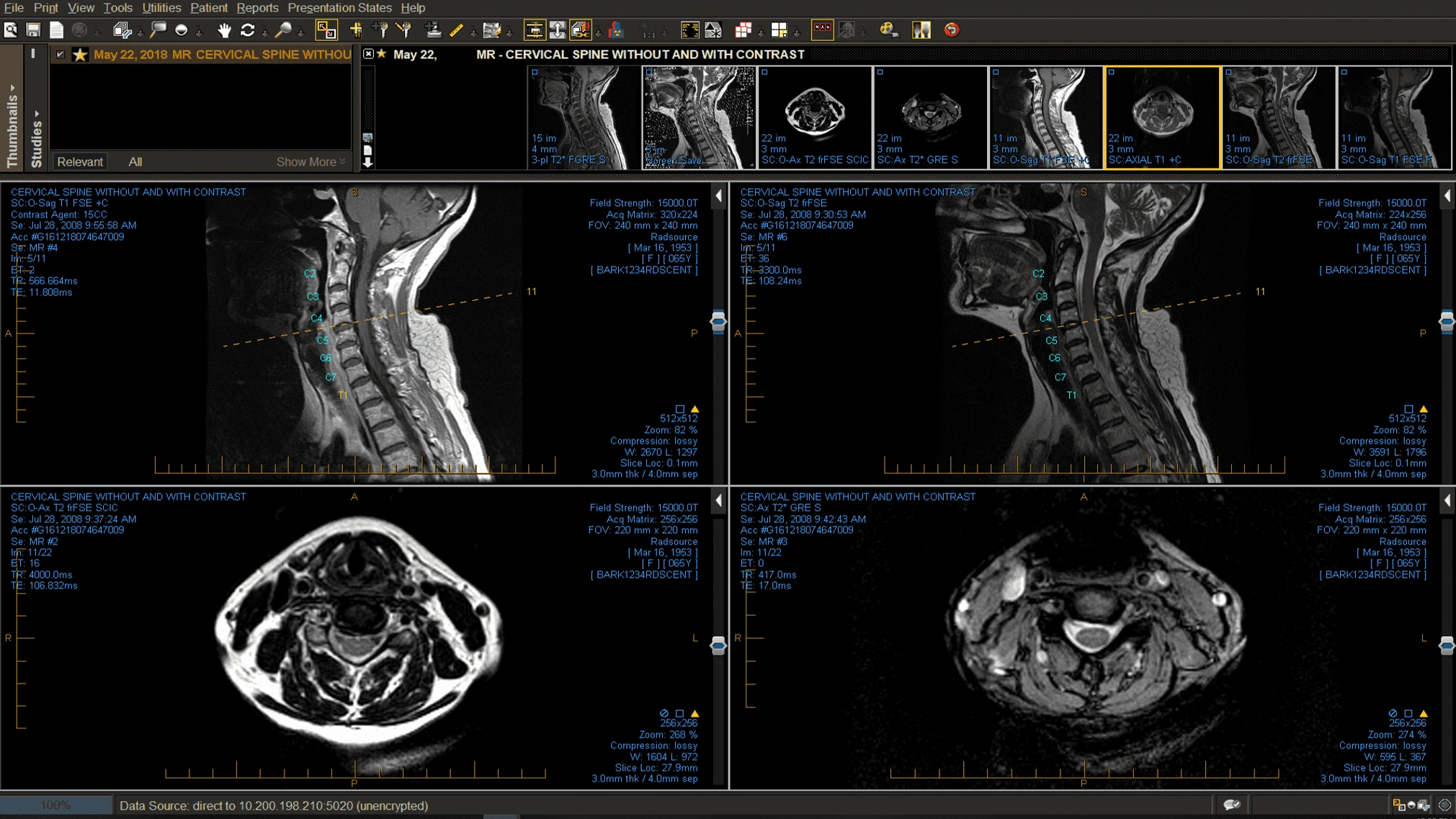 Dual view medical imaging preview