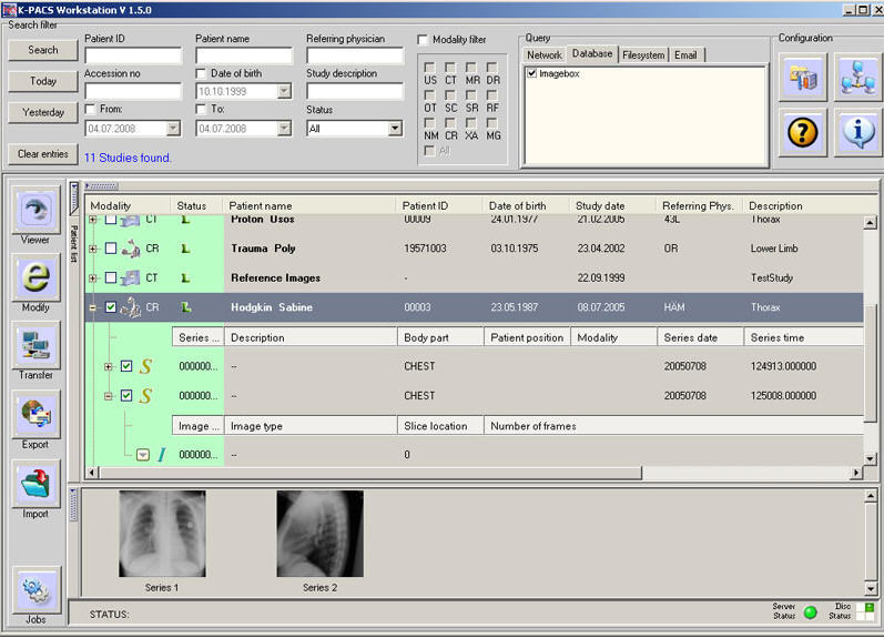 Quad view spinal cord X-ray image