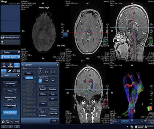 Tri view brain diagnostic image