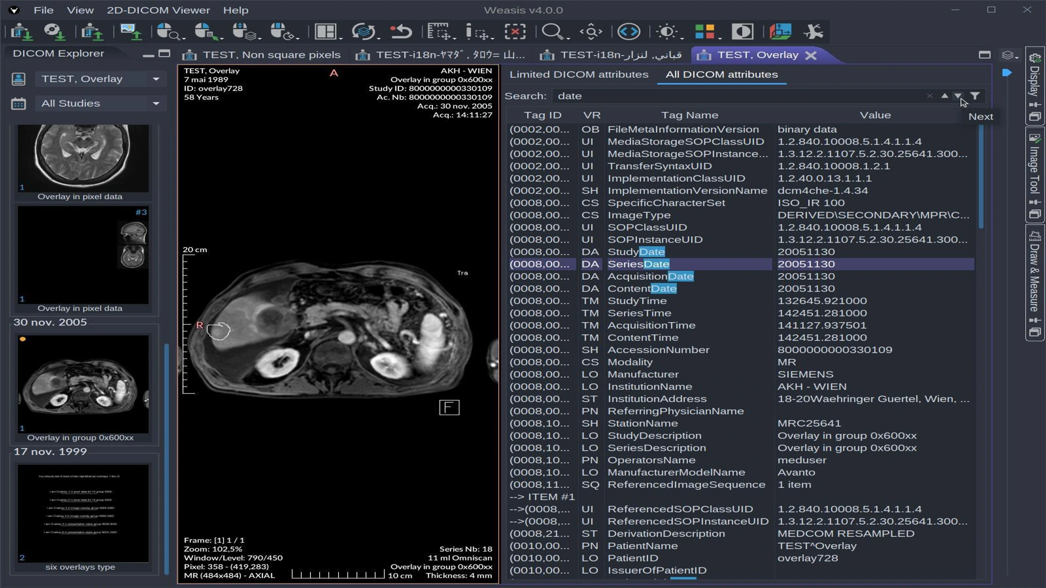Full screen medical imaging interface preview